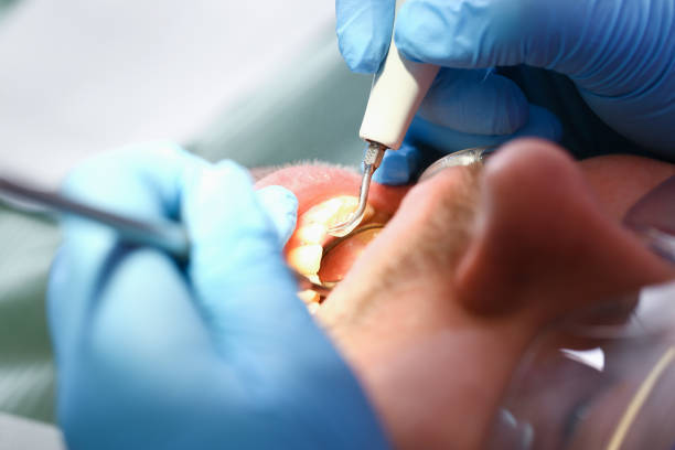Best Broken or Chipped Tooth Repair in Christiana, TN